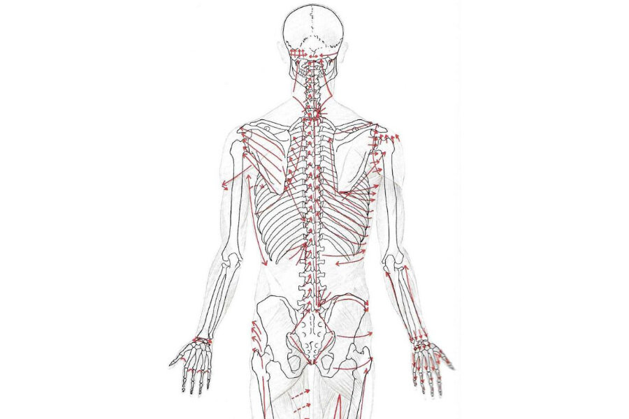 Foto Bindweefselmassage - proefles
